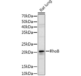 Western Blot - Anti-RhoB Antibody (A9090) - Antibodies.com