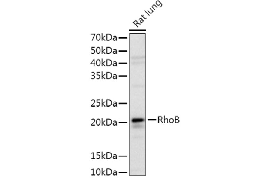 Western Blot - Anti-RhoB Antibody (A9090) - Antibodies.com