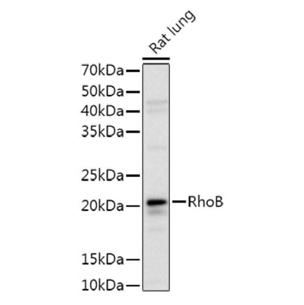 Western Blot - Anti-RhoB Antibody (A9090) - Antibodies.com