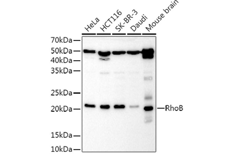 Western Blot - Anti-RhoB Antibody (A9090) - Antibodies.com