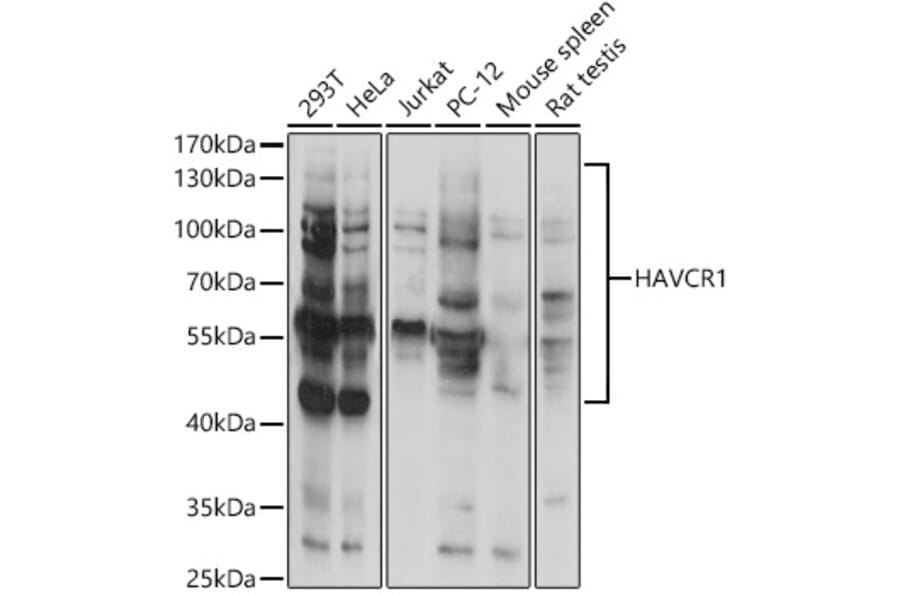 Western Blot - Anti-TIM 1 Antibody (A9092) - Antibodies.com