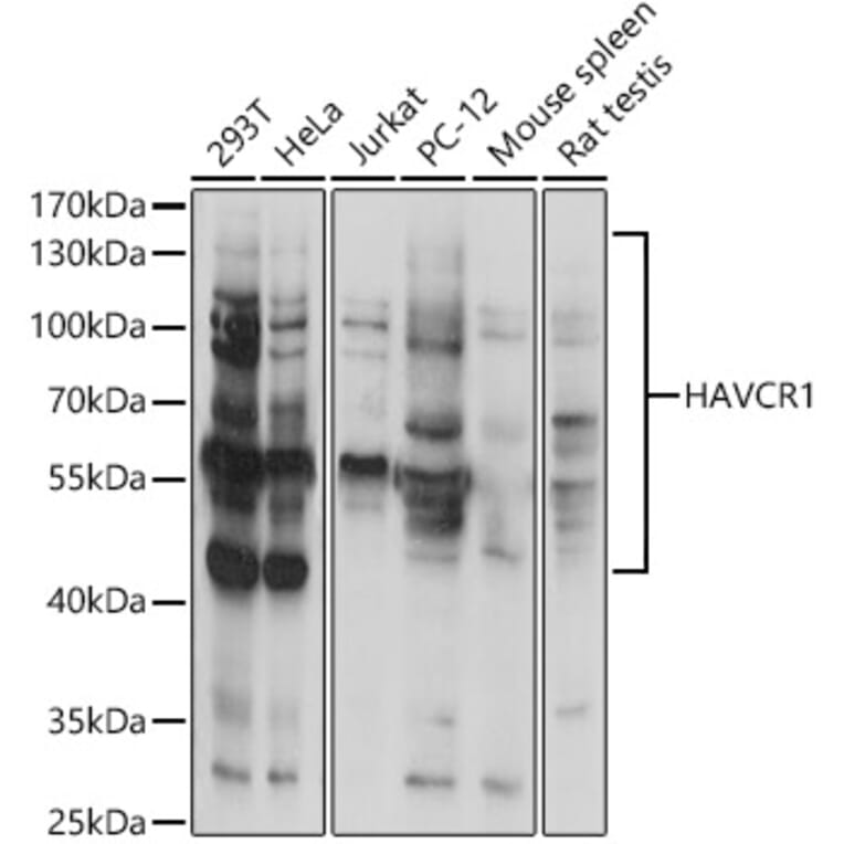 Western Blot - Anti-TIM 1 Antibody (A9092) - Antibodies.com