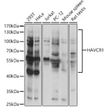 Western Blot - Anti-TIM 1 Antibody (A9092) - Antibodies.com