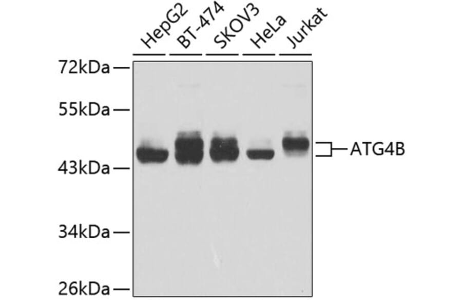 Western Blot - Anti-ATG4B Antibody (A9094) - Antibodies.com