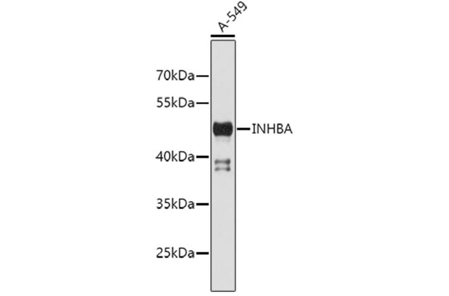 Western Blot - Anti-INHBA Antibody (A2839) - Antibodies.com
