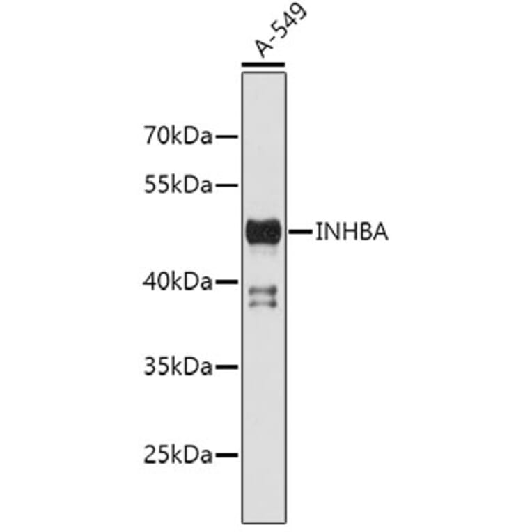 Western Blot - Anti-INHBA Antibody (A2839) - Antibodies.com