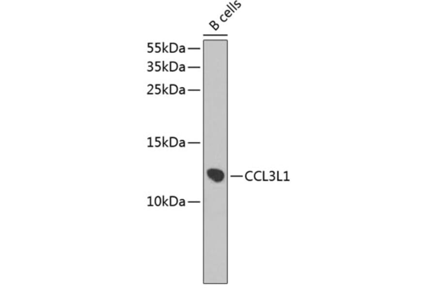 Western Blot - Anti-LD78 beta Antibody (A9096) - Antibodies.com