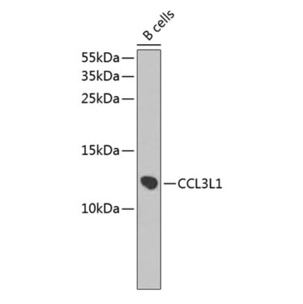 Western Blot - Anti-LD78 beta Antibody (A9096) - Antibodies.com