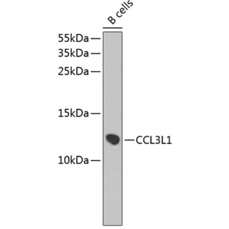 Western Blot - Anti-LD78 beta Antibody (A9096) - Antibodies.com