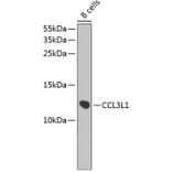 Western Blot - Anti-LD78 beta Antibody (A9096) - Antibodies.com