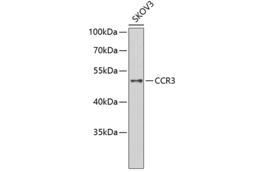 Western Blot - Anti-CCR3 Antibody (A2856) - Antibodies.com