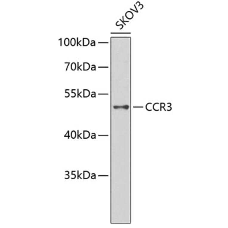 Western Blot - Anti-CCR3 Antibody (A2856) - Antibodies.com