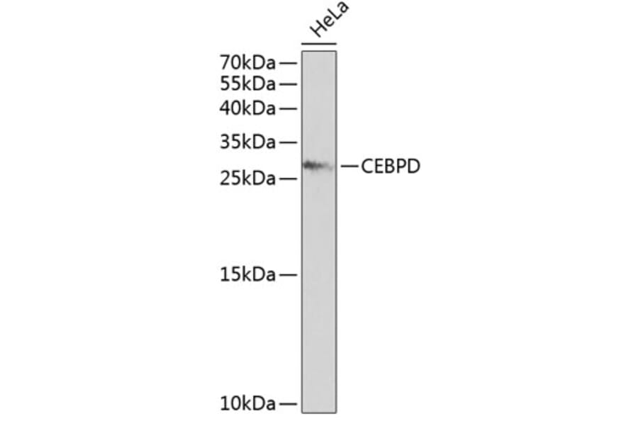 Western Blot - Anti-CEBPD Antibody (A2862) - Antibodies.com