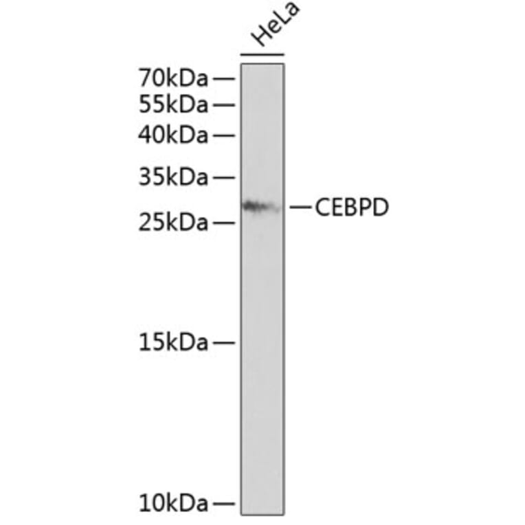 Western Blot - Anti-CEBPD Antibody (A2862) - Antibodies.com