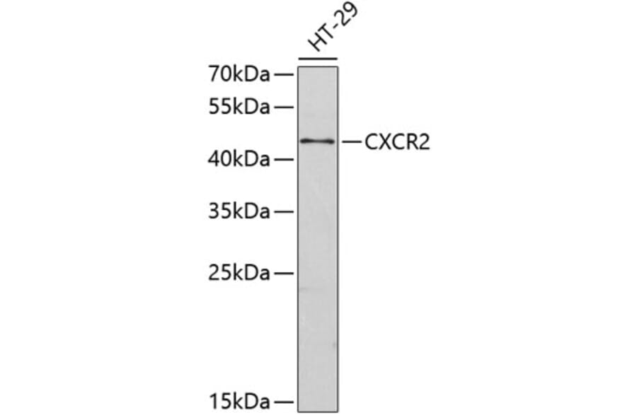 Western Blot - Anti-CXCR2 Antibody (A9105) - Antibodies.com