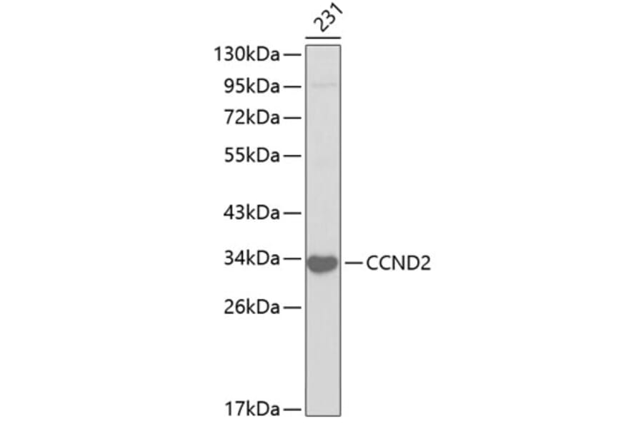 Western Blot - Anti-CCND2 Antibody (A2892) - Antibodies.com