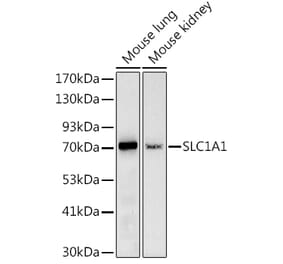 Western Blot - Anti-EAAT3 Antibody (A9108) - Antibodies.com