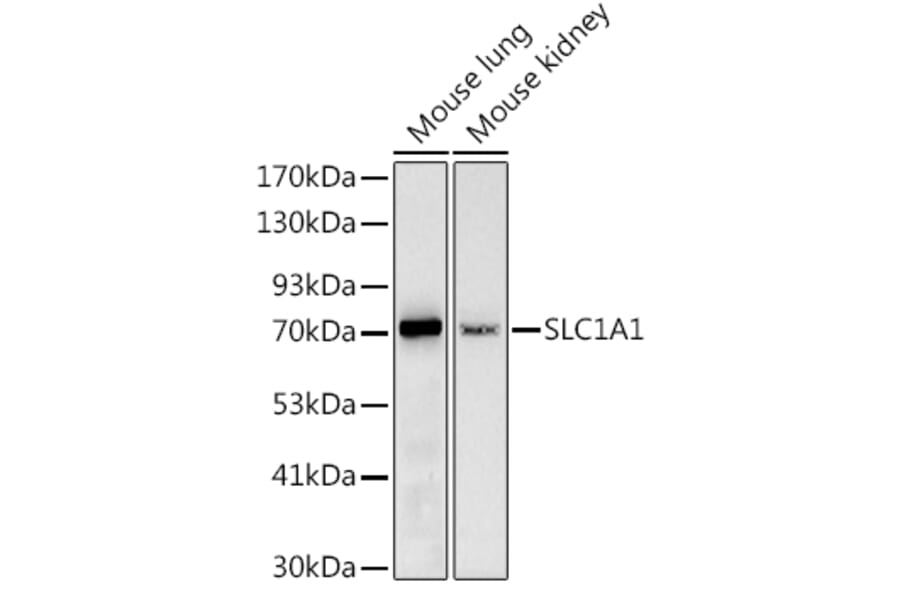Western Blot - Anti-EAAT3 Antibody (A9108) - Antibodies.com
