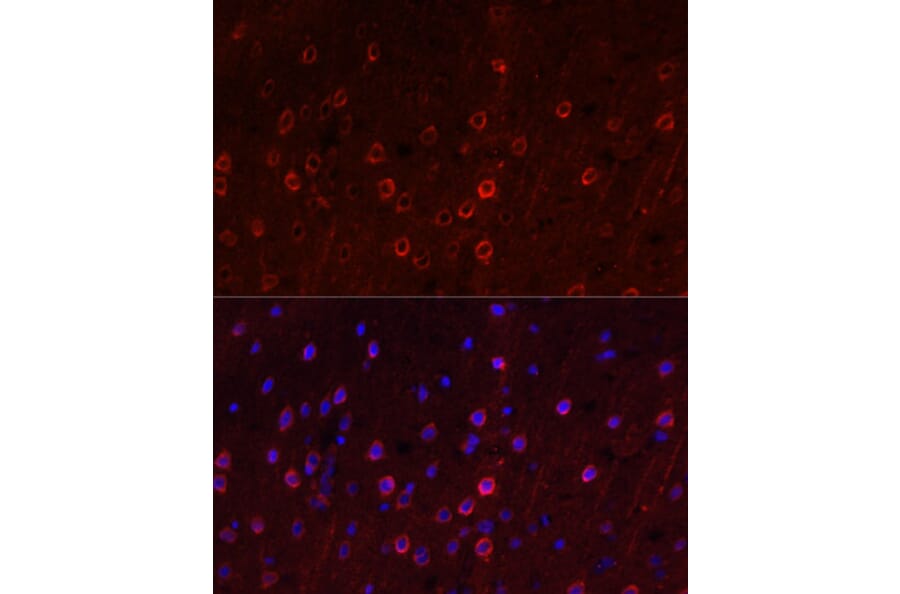 Immunofluorescence - Anti-EAAT3 Antibody (A9108) - Antibodies.com