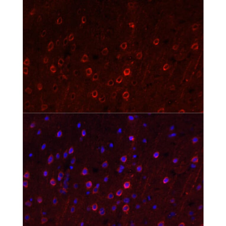 Immunofluorescence - Anti-EAAT3 Antibody (A9108) - Antibodies.com