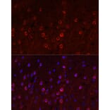 Immunofluorescence - Anti-EAAT3 Antibody (A9108) - Antibodies.com