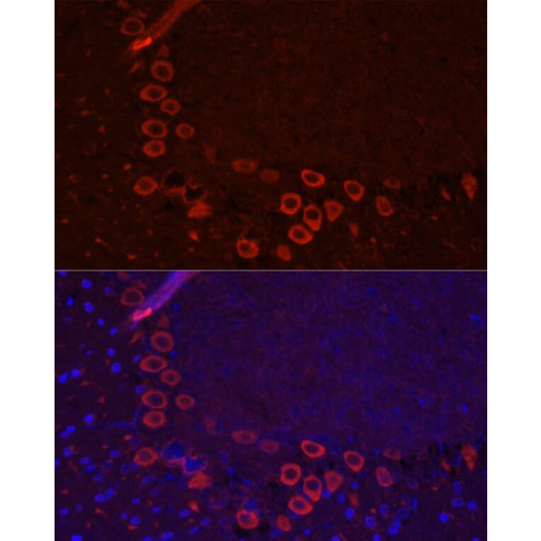 Immunofluorescence - Anti-EAAT3 Antibody (A9108) - Antibodies.com