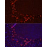 Immunofluorescence - Anti-EAAT3 Antibody (A9108) - Antibodies.com