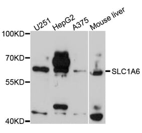 Western Blot - Anti-SLC1A6 Antibody (A9109) - Antibodies.com