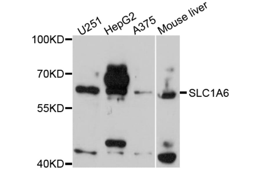 Western Blot - Anti-SLC1A6 Antibody (A2904) - Antibodies.com