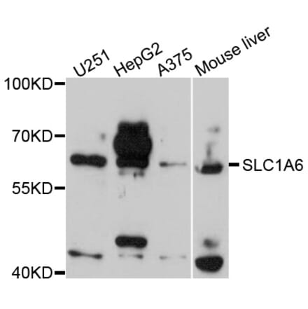 Western Blot - Anti-SLC1A6 Antibody (A9109) - Antibodies.com
