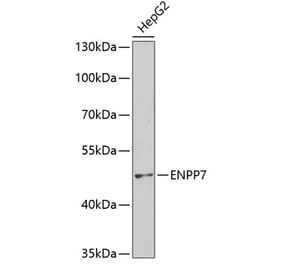 Western Blot - Anti-NPP-7 Antibody (A9110) - Antibodies.com