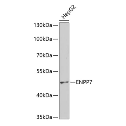 Western Blot - Anti-NPP-7 Antibody (A9110) - Antibodies.com