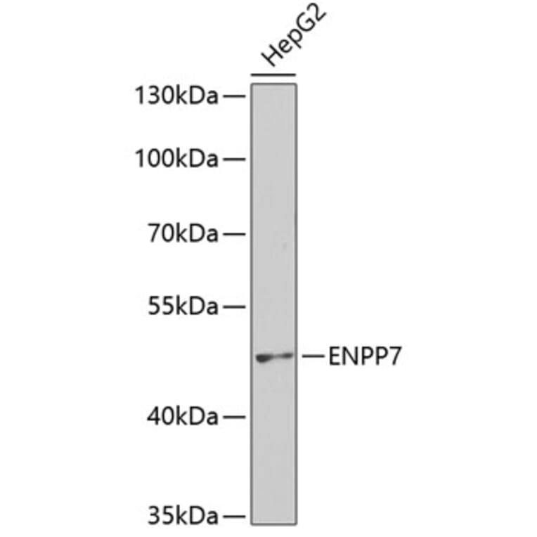 Western Blot - Anti-NPP-7 Antibody (A9110) - Antibodies.com