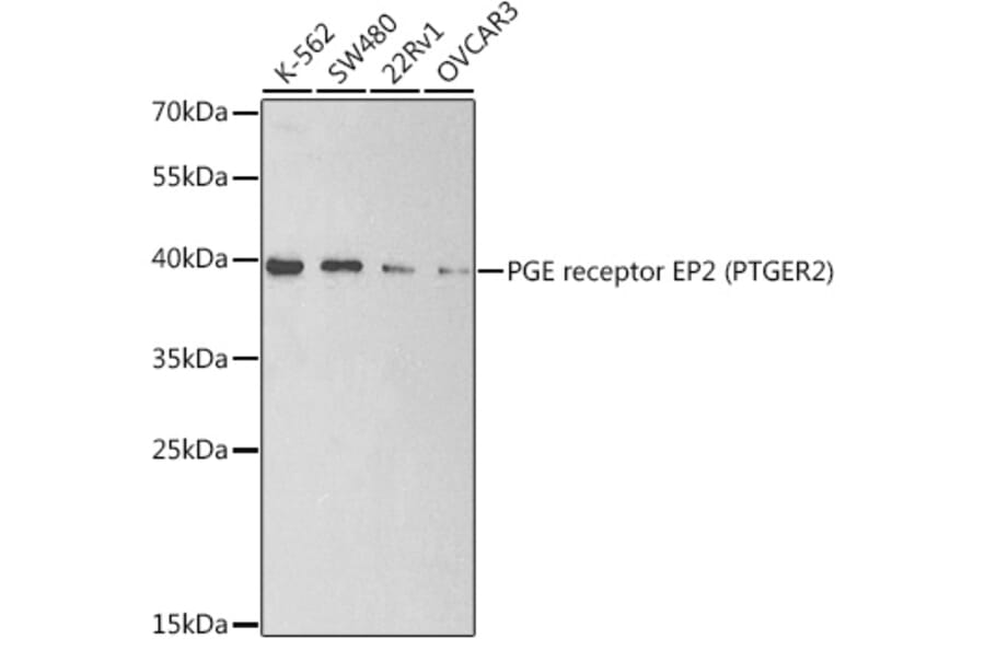 Western Blot - Anti-Prostaglandin E Receptor EP2 / PTGER2 Antibody (A9111) - Antibodies.com