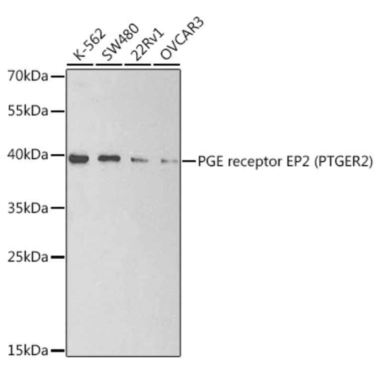 Western Blot - Anti-Prostaglandin E Receptor EP2 / PTGER2 Antibody (A9111) - Antibodies.com