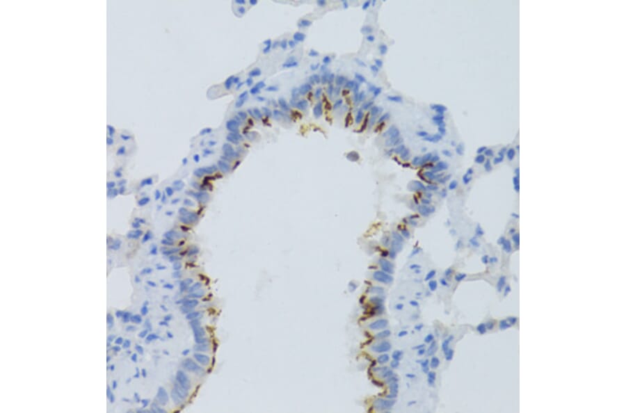 Immunohistochemistry - Anti-Prostaglandin E Receptor EP2 / PTGER2 Antibody (A9111) - Antibodies.com