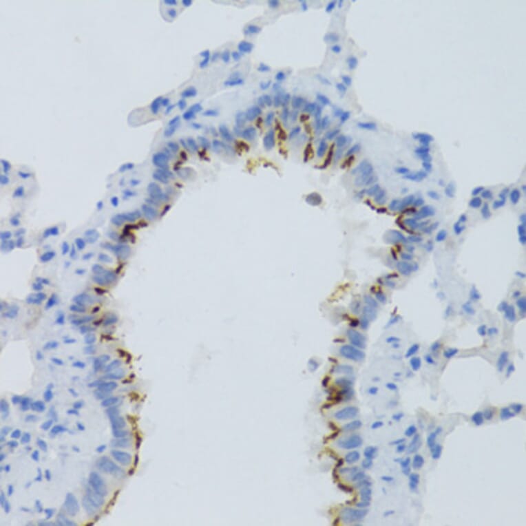 Immunohistochemistry - Anti-Prostaglandin E Receptor EP2 / PTGER2 Antibody (A9111) - Antibodies.com