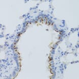 Immunohistochemistry - Anti-Prostaglandin E Receptor EP2 / PTGER2 Antibody (A9111) - Antibodies.com