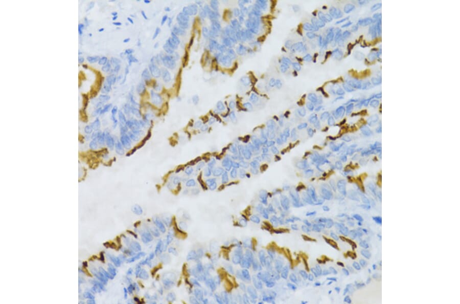 Immunohistochemistry - Anti-Prostaglandin E Receptor EP2 / PTGER2 Antibody (A9111) - Antibodies.com