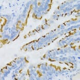 Immunohistochemistry - Anti-Prostaglandin E Receptor EP2 / PTGER2 Antibody (A9111) - Antibodies.com