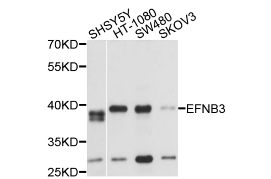 Western Blot - Anti-EFNB3 Antibody (A2916) - Antibodies.com