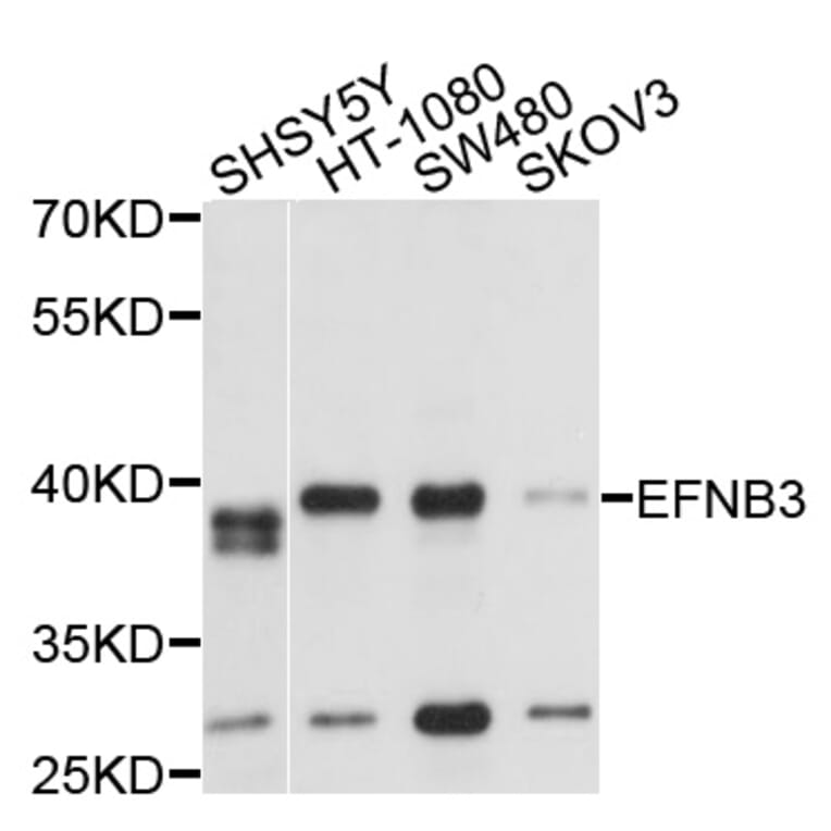 Western Blot - Anti-EFNB3 Antibody (A2916) - Antibodies.com