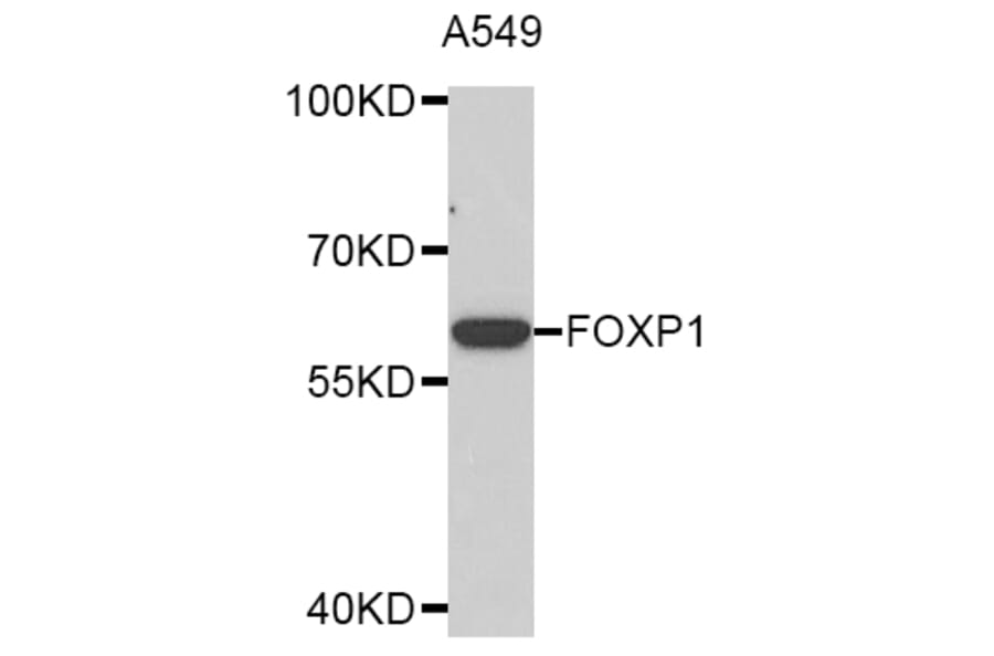 Western Blot - Anti-FOXP1 Antibody (A2935) - Antibodies.com