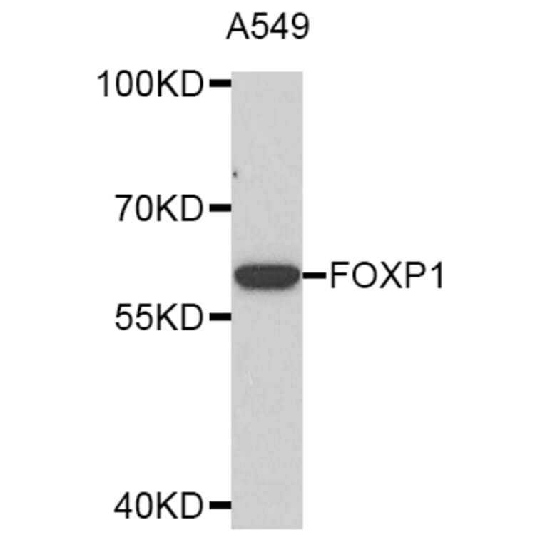 Western Blot - Anti-FOXP1 Antibody (A2935) - Antibodies.com