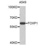 Western Blot - Anti-FOXP1 Antibody (A2935) - Antibodies.com