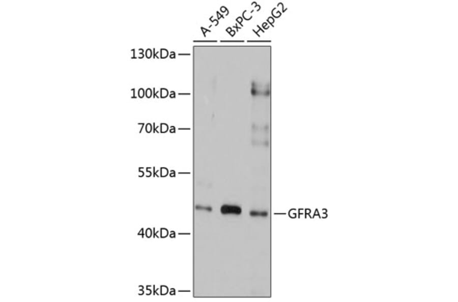 Western Blot - Anti-GFR alpha 3/GFRA3 Antibody (A9117) - Antibodies.com