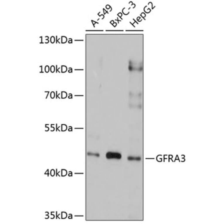 Western Blot - Anti-GFR alpha 3/GFRA3 Antibody (A9117) - Antibodies.com