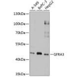 Western Blot - Anti-GFR alpha 3/GFRA3 Antibody (A9117) - Antibodies.com