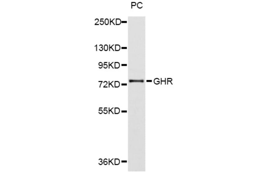 Western Blot - Anti-GHR Antibody (A2956) - Antibodies.com