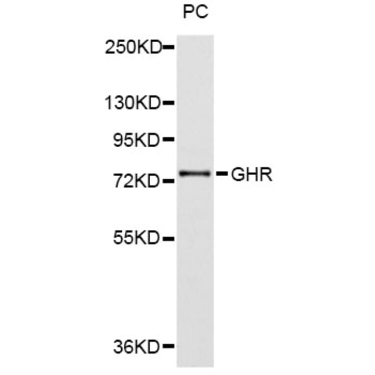 Western Blot - Anti-GHR Antibody (A2956) - Antibodies.com
